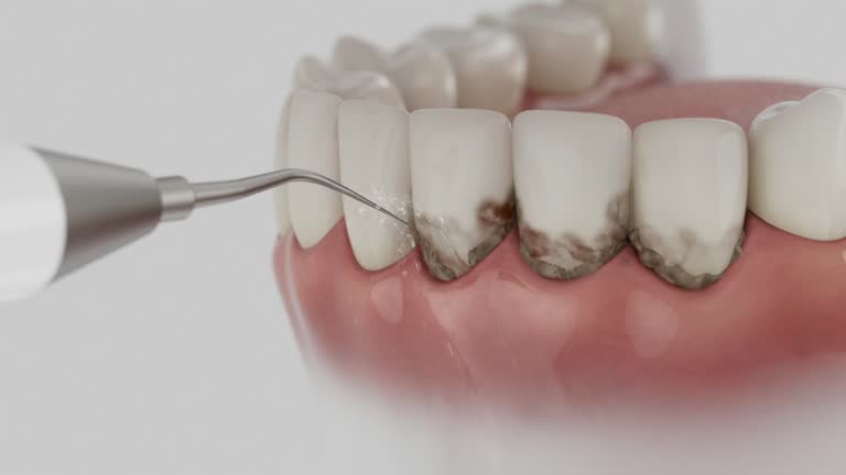 Trusted Wisdom Tooth Removal service in North Utica, IL - Dentist Open Now